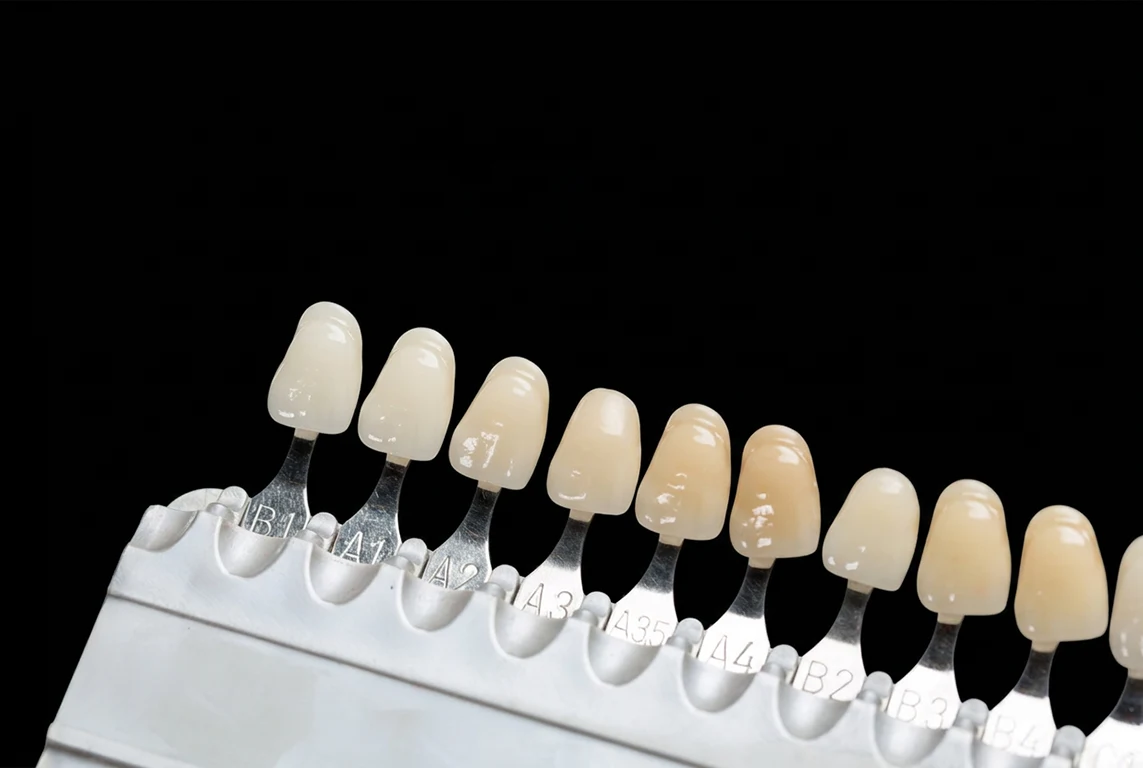 Dental shade guide showing a range of tooth shades
