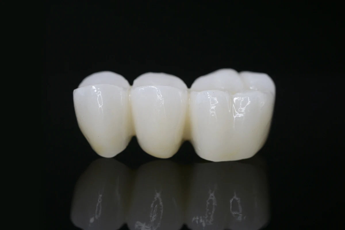 Restorative Crowns