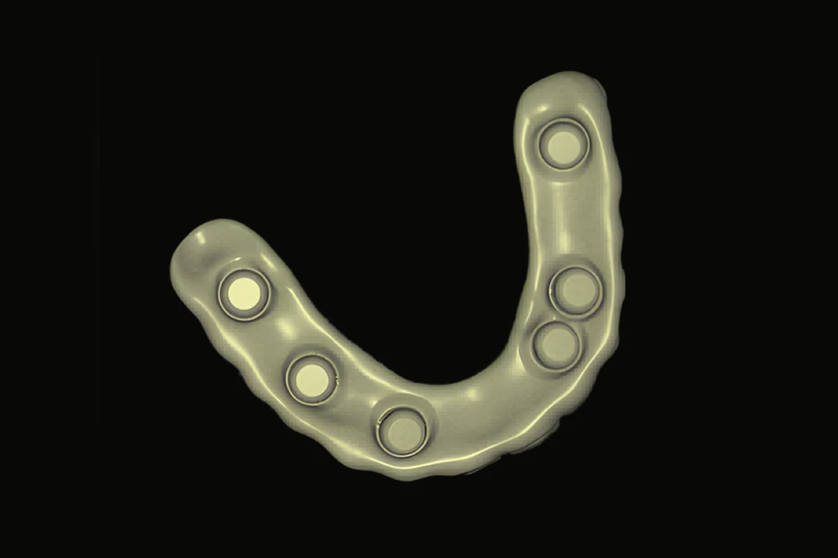 Surgical Guides & Stents